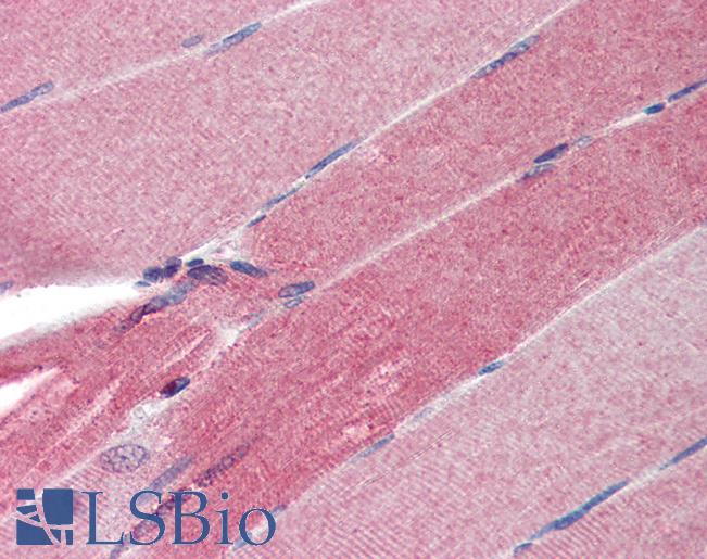 SLIM / FHL1 Antibody - Anti-FHL1 antibody IHC of human skeletal muscle. Immunohistochemistry of formalin-fixed, paraffin-embedded tissue after heat-induced antigen retrieval. Antibody concentration 5 ug/ml.  This image was taken for the unconjugated form of this product. Other forms have not been tested.