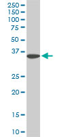 SLIM / FHL1 Antibody - FHL1 monoclonal antibody (M01), clone 2A9. Western Blot analysis of FHL1 expression in PC-12.