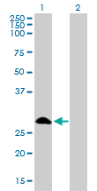 SLIM / FHL1 Antibody - Western Blot analysis of FHL1 expression in transfected 293T cell line by FHL1 monoclonal antibody (M01), clone 2A9.Lane 1: FHL1 transfected lysate(31.9 KDa).Lane 2: Non-transfected lysate.
