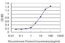 SLIM / FHL1 Antibody - Detection limit for recombinant GST tagged FHL1 is approximately 0.3 ng/ml as a capture antibody.