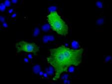 SLIM / FHL1 Antibody - Anti-FHL1 mouse monoclonal antibody  immunofluorescent staining of COS7 cells transiently transfected by pCMV6-ENTRY FHL1.