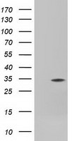 SLIM / FHL1 Antibody - HEK293T cells were transfected with the pCMV6-ENTRY control (Left lane) or pCMV6-ENTRY FHL1 (Right lane) cDNA for 48 hrs and lysed. Equivalent amounts of cell lysates (5 ug per lane) were separated by SDS-PAGE and immunoblotted with anti-FHL1.
