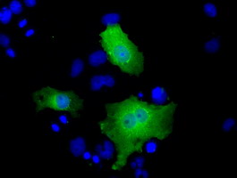 SLIM / FHL1 Antibody - Anti-FHL1 mouse monoclonal antibody  immunofluorescent staining of COS7 cells transiently transfected by pCMV6-ENTRY FHL1.