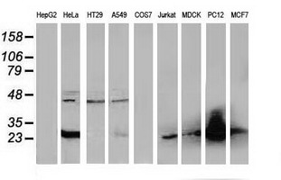 SLIM / FHL1 Antibody - Western blot of extracts (35 ug) from 9 different cell lines by using anti-FHL1 monoclonal antibody.