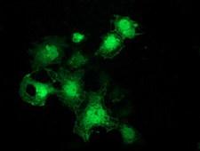 SLIM / FHL1 Antibody - Anti-FHL1 mouse monoclonal antibody immunofluorescent staining of COS7 cells transiently transfected by pCMV6-ENTRY FHL1.