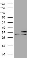 SLIM / FHL1 Antibody - HEK293T cells were transfected with the pCMV6-ENTRY control (Left lane) or pCMV6-ENTRY FHL1 (Right lane) cDNA for 48 hrs and lysed. Equivalent amounts of cell lysates (5 ug per lane) were separated by SDS-PAGE and immunoblotted with anti-FHL1.