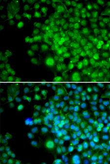 SLIM / FHL1 Antibody - Immunofluorescence analysis of HeLa cell using FHL1 antibody. Blue: DAPI for nuclear staining.