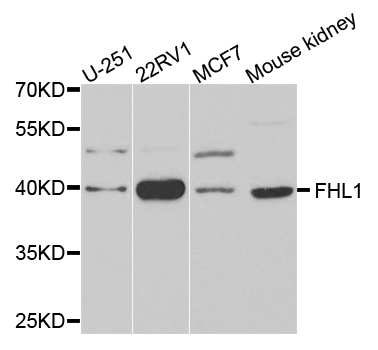 SLIM / FHL1 Antibody - Western blot analysis of extracts of various cells.