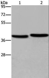 SLIM / FHL1 Antibody - Western blot analysis of MCF-7 and NIH/3T3 cell, using FHL1 Polyclonal Antibody at dilution of 1:400.