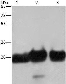 SLIM / FHL1 Antibody - Western blot analysis of Human adrenal pheochromocytoma, fetal muscle and skeletal muscle tissue, using FHL1 Polyclonal Antibody at dilution of 1:500.