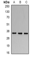 SLIM / FHL1 Antibody - Western blot analysis of FHL-1 expression in 22RV1 (A); MCF7 (B); mouse kidney (C) whole cell lysates.