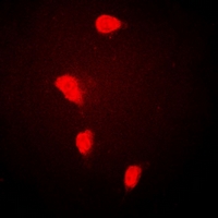 SLIM / FHL1 Antibody - Immunofluorescent analysis of FHL-1 staining in HeLa cells. Formalin-fixed cells were permeabilized with 0.1% Triton X-100 in TBS for 5-10 minutes and blocked with 3% BSA-PBS for 30 minutes at room temperature. Cells were probed with the primary antibody in 3% BSA-PBS and incubated overnight at 4 deg C in a humidified chamber. Cells were washed with PBST and incubated with a DyLight 594-conjugated secondary antibody (red) in PBS at room temperature in the dark.