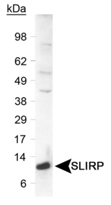 SLIRP / C14orf156 Antibody - Detection of SLIRP protein in a human liver lysate. Primary was used at 0.6 ug/ml.  This image was taken for the unconjugated form of this product. Other forms have not been tested.