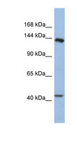 SLIT1 Antibody - SLIT1 antibody Western blot of Fetal Stomach lysate. This image was taken for the unconjugated form of this product. Other forms have not been tested.