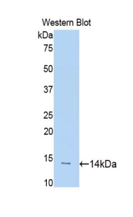 SLIT1 Antibody - Western blot of recombinant SLIT1 / SLIT-1.  This image was taken for the unconjugated form of this product. Other forms have not been tested.