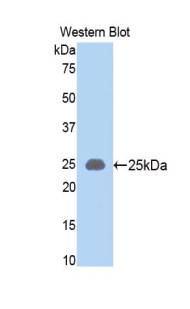 SLIT1 Antibody - Western blot of recombinant SLIT1 / SLIT-1.  This image was taken for the unconjugated form of this product. Other forms have not been tested.