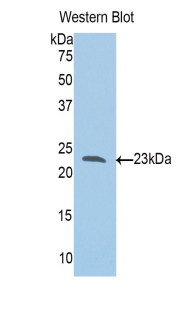 SLIT1 Antibody - Western blot of recombinant SLIT1 / SLIT-1.  This image was taken for the unconjugated form of this product. Other forms have not been tested.