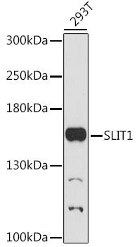SLIT1 Antibody - Western blot analysis of extracts of 293T cells using SLIT1 Polyclonal Antibody at dilution of 1:1000.