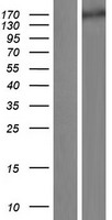 SLIT1 Protein - Western validation with an anti-DDK antibody * L: Control HEK293 lysate R: Over-expression lysate