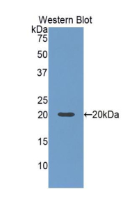 SLIT2 Antibody - Western blot of recombinant SLIT2 / SLIT-2.  This image was taken for the unconjugated form of this product. Other forms have not been tested.