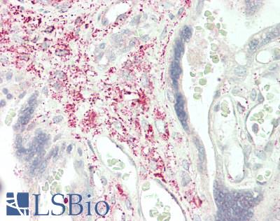 SLIT2 Antibody - Human Placenta: Formalin-Fixed, Paraffin-Embedded (FFPE)
