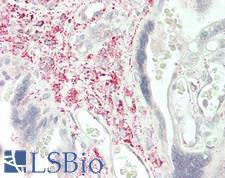 SLIT2 Antibody - Human Placenta: Formalin-Fixed, Paraffin-Embedded (FFPE)