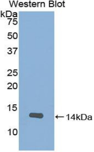 SLIT2 Antibody - Western blot of SLIT3 antibody.