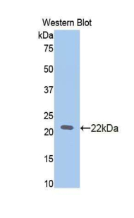 SLIT2 Antibody - Western blot of recombinant SLIT2 / SLIT-2.  This image was taken for the unconjugated form of this product. Other forms have not been tested.
