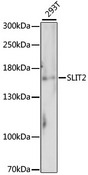 SLIT2 Antibody - Western blot analysis of extracts of 293T cells, using SLIT2 antibody. The secondary antibody used was an HRP Goat Anti-Rabbit IgG (H+L) at 1:10000 dilution. Lysates were loaded 25ug per lane and 3% nonfat dry milk in TBST was used for blocking. An ECL Kit was used for detection and the exposure time was 90s.