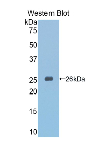 SLIT3 Antibody - Western blot of recombinant SLIT3.  This image was taken for the unconjugated form of this product. Other forms have not been tested.