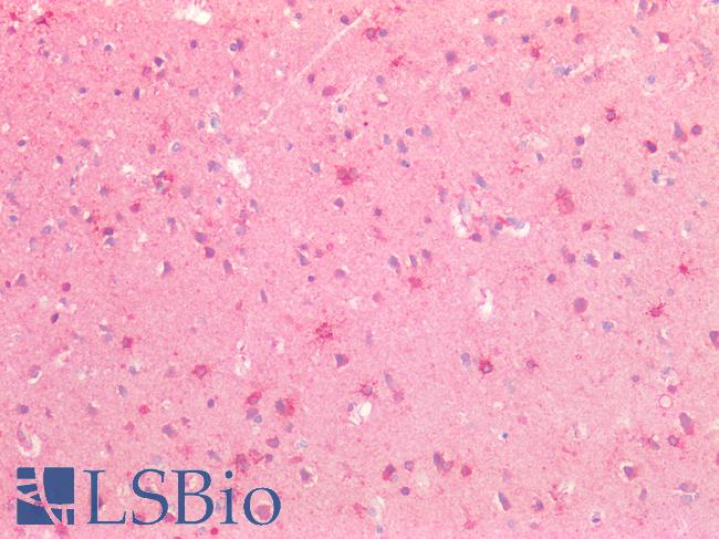 SLIT3 Antibody - Human Brain, Cortex: Formalin-Fixed, Paraffin-Embedded (FFPE)