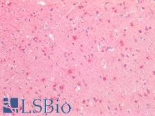 SLIT3 Antibody - Human Brain, Cortex: Formalin-Fixed, Paraffin-Embedded (FFPE)