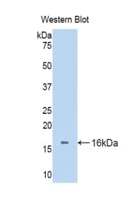 SLIT3 Antibody - Western blot of recombinant SLIT3.  This image was taken for the unconjugated form of this product. Other forms have not been tested.