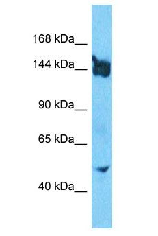 SLIT3 Antibody - SLIT3 antibody Western Blot of HepG2. Antibody dilution: 1 ug/ml.  This image was taken for the unconjugated form of this product. Other forms have not been tested.