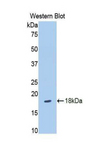 SLIT3 Antibody - Western blot of recombinant SLIT3.  This image was taken for the unconjugated form of this product. Other forms have not been tested.
