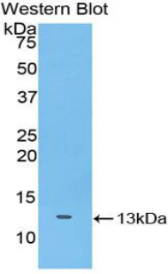 SLIT3 Antibody - Western blot of recombinant SLIT3.  This image was taken for the unconjugated form of this product. Other forms have not been tested.