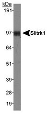 SLITRK1 Antibody - Western Blot: Slitrk1 Antibody - Analysis of Slitrk1 in human brain lysate.  This image was taken for the unconjugated form of this product. Other forms have not been tested.