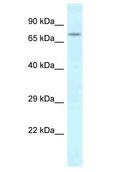 SLITRK1 Antibody - SLITRK1 antibody Western Blot of Mouse Heart. Antibody dilution: 1 ug/ml.  This image was taken for the unconjugated form of this product. Other forms have not been tested.