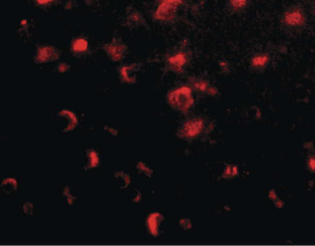 SLITRK1 Antibody - Immunofluorescence of slitrk1 in human brain tissue with slitrk1 antibody at 20 ug/ml.