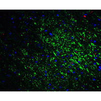 SLITRK1 Antibody - Immunofluorescence of Slitrk1 in mouse brain tissue with Slitrk1 Antibodyat 20 µg/mL.Green: Slitrk1 antibody  Red: Phylloidin staining Blue: DAPI staining