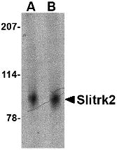 SLITRK2 Antibody - Western blot of Slitrk2 in mouse brain tissue lysate with Slitrk2 antibody at (A) 1 and (B) 2 ug/ml.