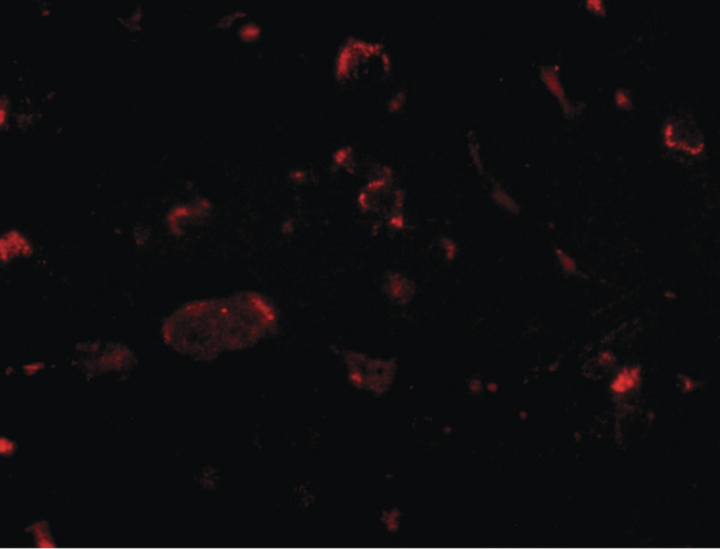 SLITRK2 Antibody - Immunofluorescence of slitrk2 in human brain tissue with slitrk2 antibody at 20 ug/ml.