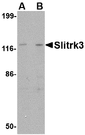 SLITRK3 Antibody - Western blot of Slitrk3 in SK-N-SH cell lysate with Slitrk3 antibody at (A) 0.25 and (B) 0.5 ug/ml.