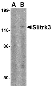 SLITRK3 Antibody - Western blot of Slitrk3 in SK-N-SH cell lysate with Slitrk3 antibody at (A) 0.5 and (B) 1 ug/ml.