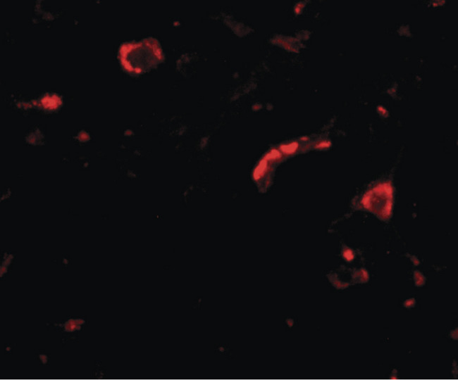 SLITRK3 Antibody - Immunofluorescence of slitrk3 in human brain tissue with slitrk3 antibody at 20 ug/ml.