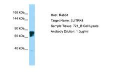 SLITRK4 Antibody -  This image was taken for the unconjugated form of this product. Other forms have not been tested.