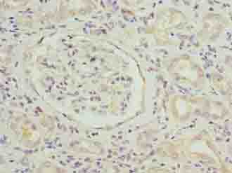 SLITRK4 Antibody - Immunohistochemistry of paraffin-embedded human kidney tissue using antibody at dilution of 1:100.