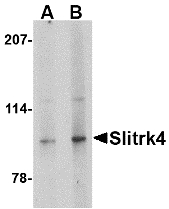 SLITRK4 Antibody - Western blot of Slitrk4 in mouse brain tissue lysate with Slitrk4 antibody at (A) 0.5 and (B) 1 ug/ml.