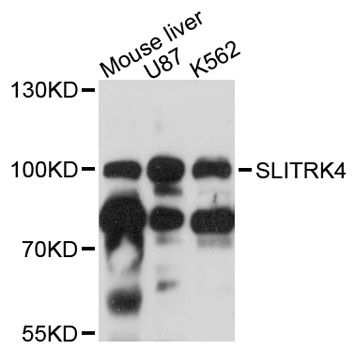 SLITRK4 Antibody - Western blot analysis of extracts of various cell lines, using SLITRK4 antibody at 1:3000 dilution. The secondary antibody used was an HRP Goat Anti-Rabbit IgG (H+L) at 1:10000 dilution. Lysates were loaded 25ug per lane and 3% nonfat dry milk in TBST was used for blocking. An ECL Kit was used for detection and the exposure time was 30s.