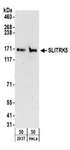 SLITRK5 Antibody - Detection of Human SLITRK5 by Western Blot. Samples: Whole cell lysate (50 ug) from 293T and HeLa cells. Antibodies: Affinity purified rabbit anti-SLITRK5 antibody used for WB at 0.4 ug/ml. Detection: Chemiluminescence with an exposure time of 3 minutes.